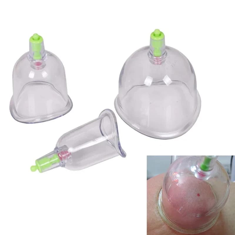 Appareil de massage traditionnel chinois, 3 pièces, courbé, C1, standardisation, pour aspiration articulaire