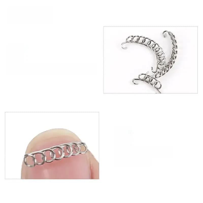 Outil de réparation des ongles des orteils incarnés 12 pièce/ensemble, Patch orthodontique pour lime Paronychia, récupérer les ongles des orteils, correcteur de lissage, soin des pieds