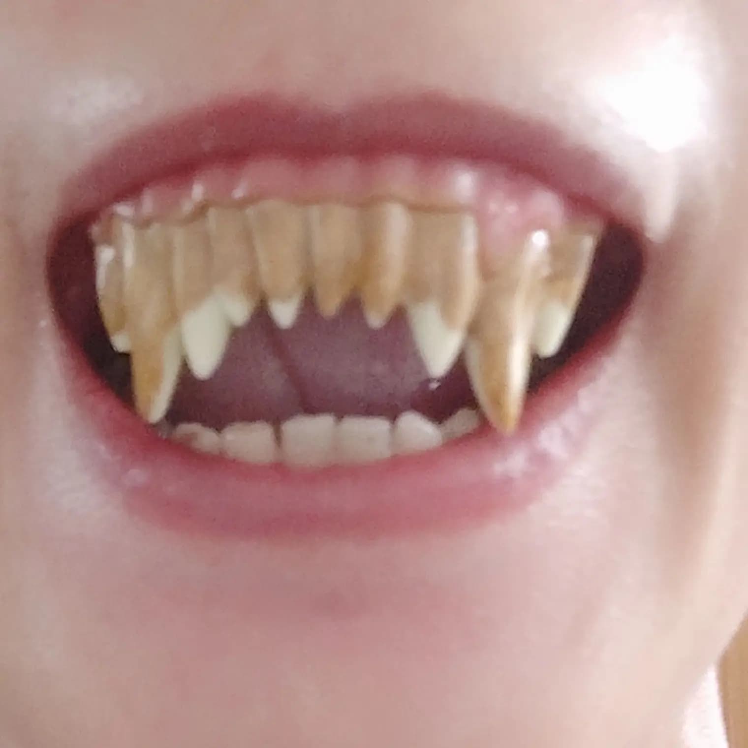 Dents d'horreur de carnaval, fête d'halloween, prothèses zombie avec pâte thermoplastique moulable incluse, postiches de fête, halloween