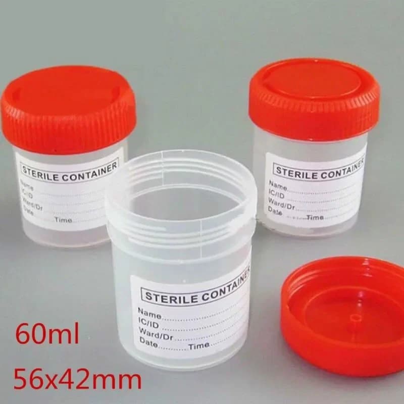 Tasse d'échantillon de collecte d'urine, 5 pièces, bouteille d'échantillon, conteneur de tasse en plastique de 60ML à utiliser