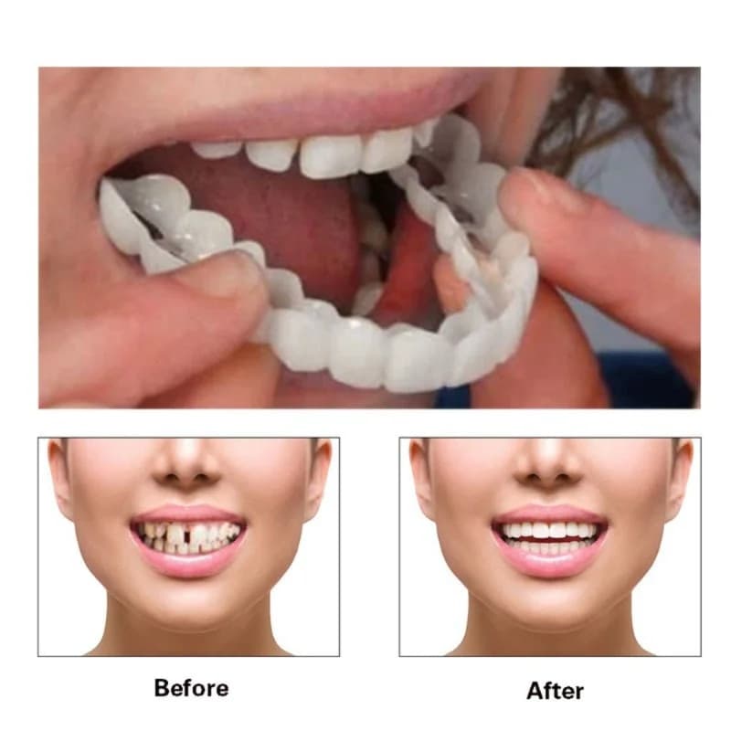 Adjustable Set Instant Smiling Veneer Whitening Tooth Denture Braces Decorate The Gaps Between Teeth