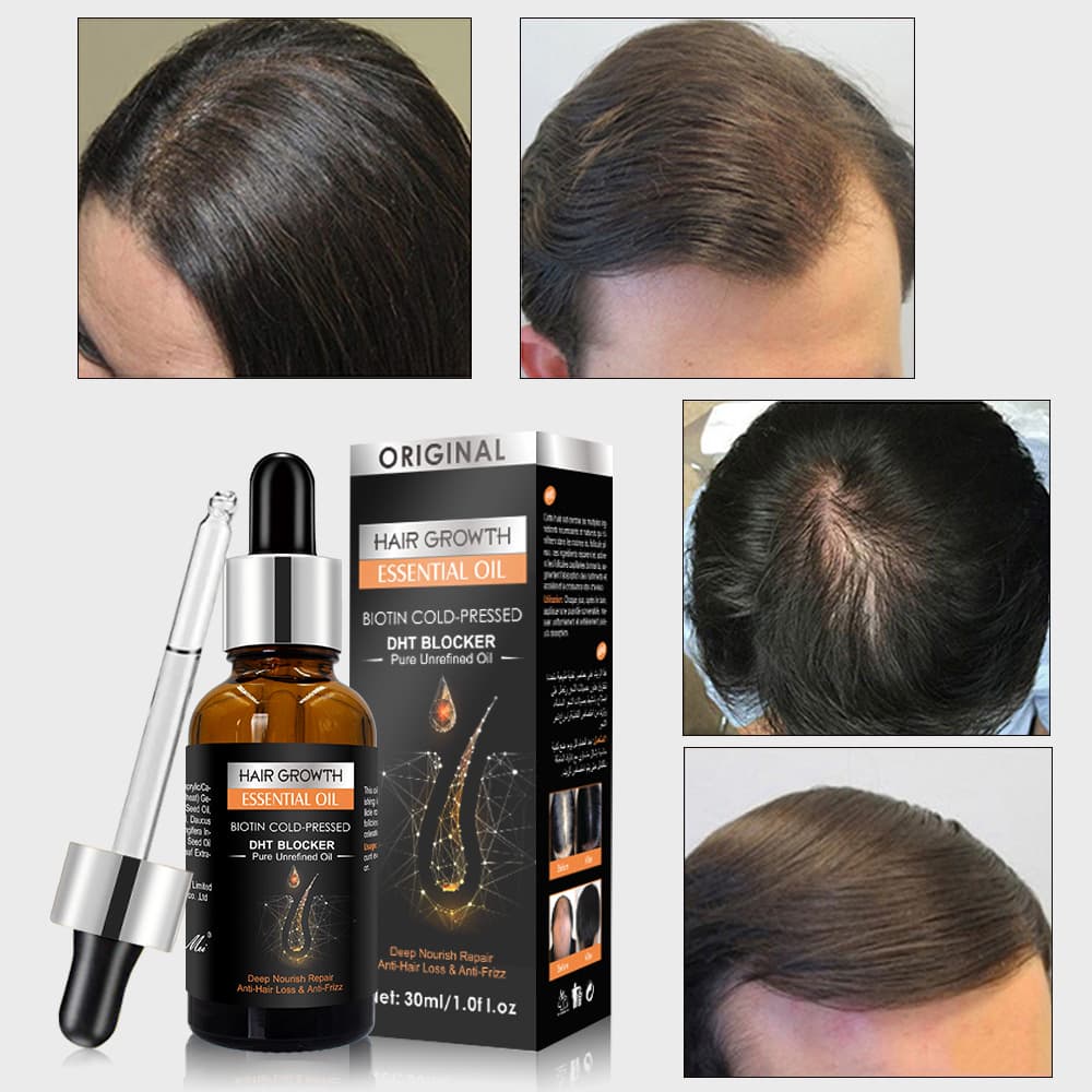 wash Ginger scalp free hair care massage essential Hair growth oil