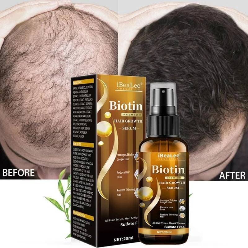 20ml Hair Growth Serum, Biotin Hair Growth Spray, Hair Growth Serum for Thicker Longer & Stronger Hair