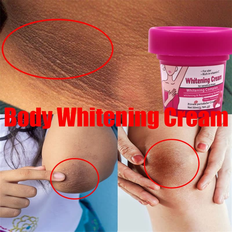 Body Whitening Bleach Cream Brighten Underarm Elbow Knees Joint Removal Intimate Parts Dark Spots Melanin Snow Bleach Cream