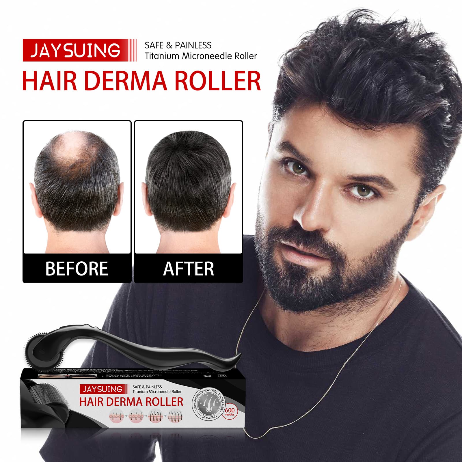 Promotes Jaysuing Scalp Thickening Roller Massage Hair Comb
