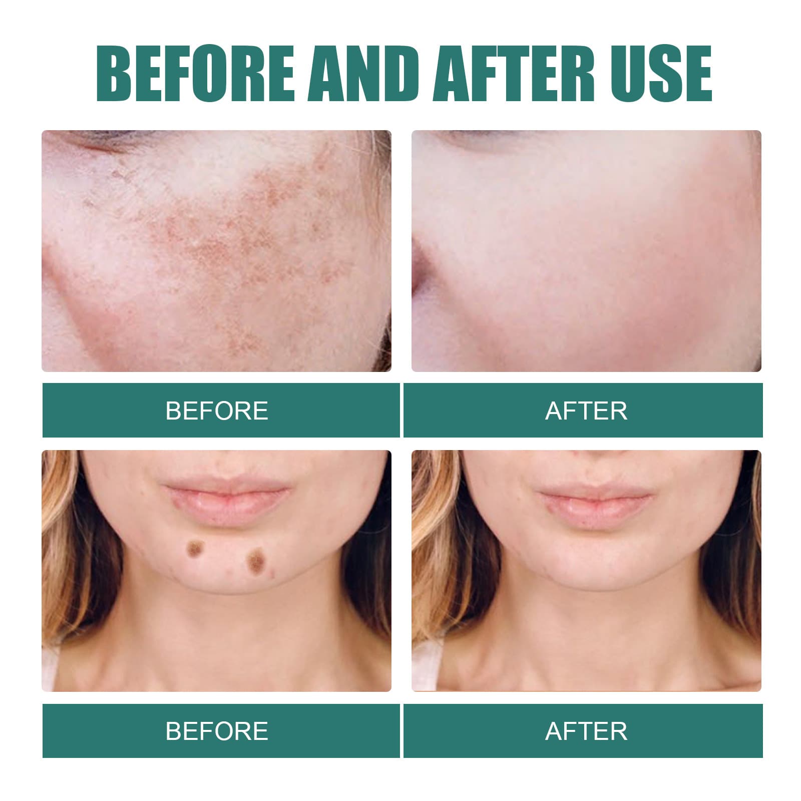 EELHOE Whitening&Attenuating Spot Cream Moisturizing&Attenuating Stain Skin Whitening&Transparent Anti Aging Face Cream