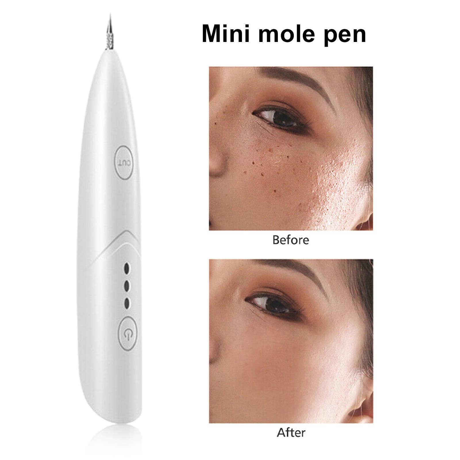 Hislaves 1 Set Skin Tag Remover Laser Plasma Multi-functional Portable Dark Spot Remover Tool Pen Beauty Equipment