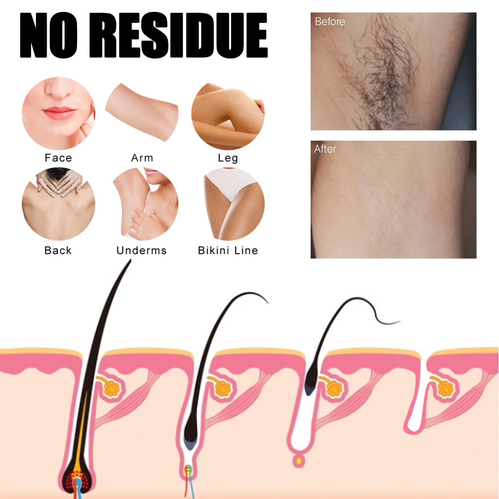 Most popular armpit mild refreshing and non stimulating fine smooth hair removal spray