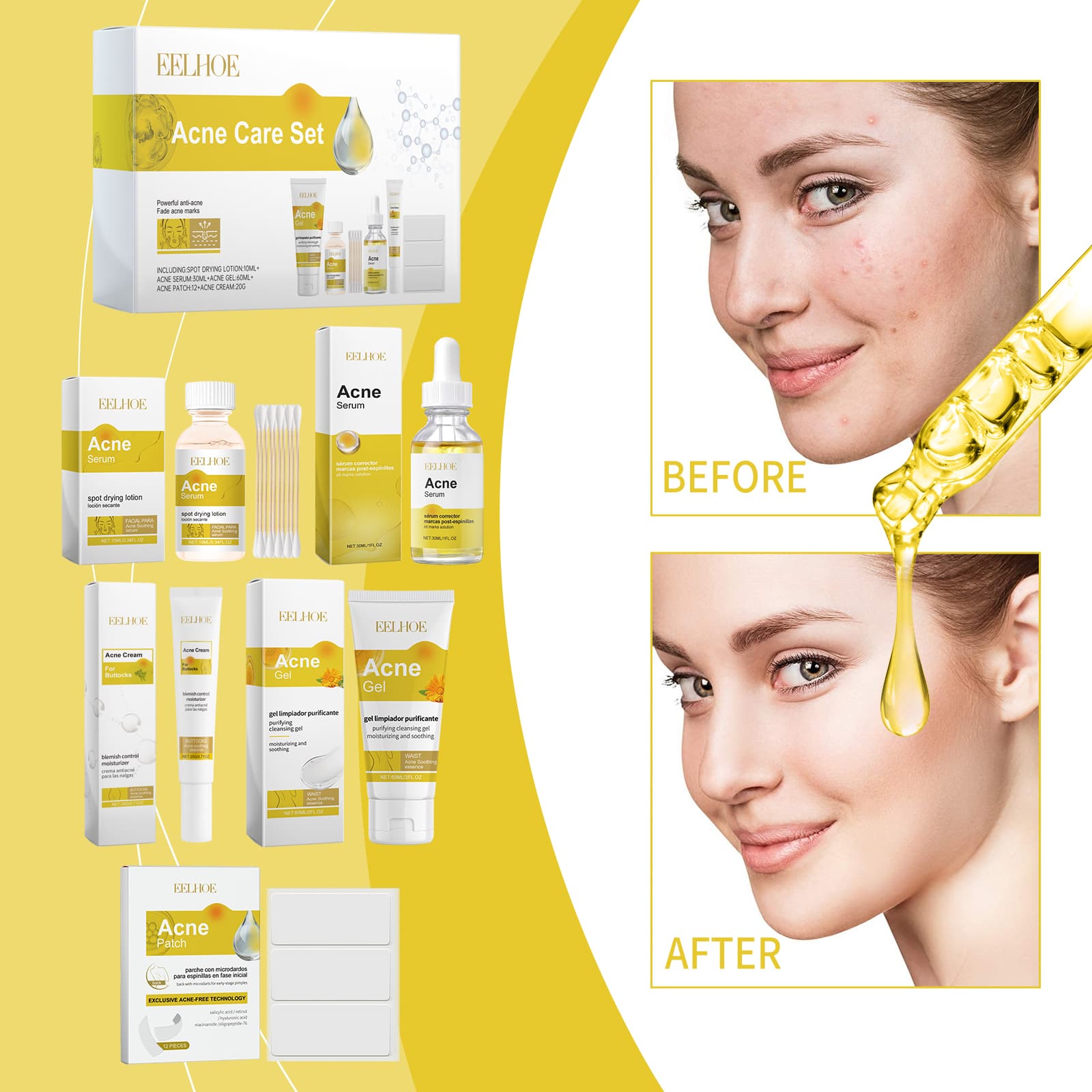 EELHOE Acne Skin Care Set Skin Care For Acne Skin Is Suitable For Moisturizing And Beautify Soft Skin