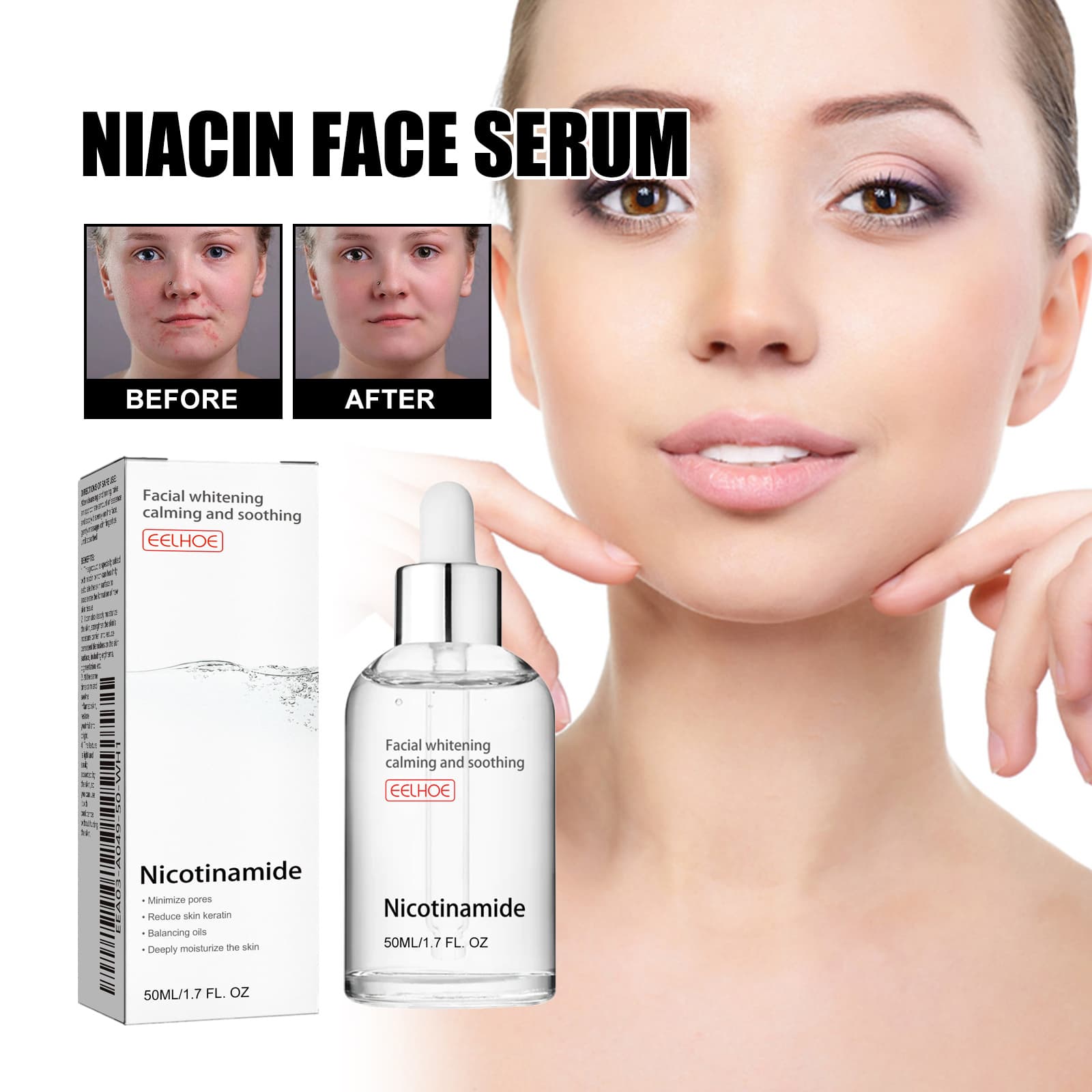 EELHOE Nicotinic Acid Face Essence Lighten Acne Marks, Moisturize Pores, Shrink And Whiten Skin Beauty Essence