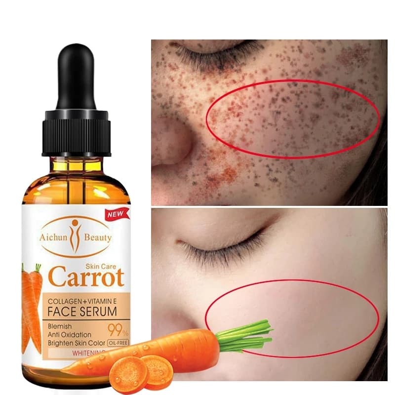 Spot Corrector Dark Whitening Face Bleaching Serum Brighten Blemish Freckle Remover Natural Carrot Essence Korea