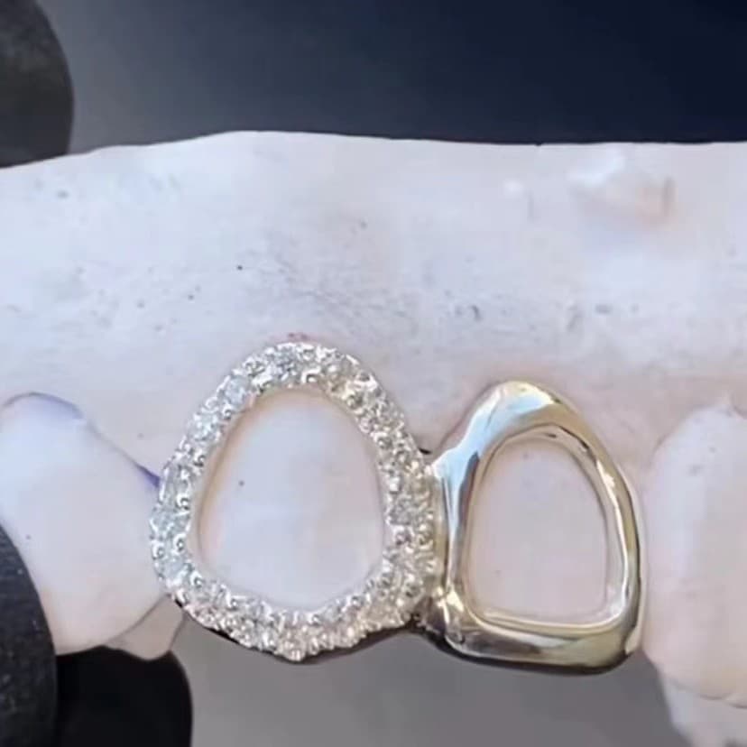 Dental Grill Braces Hip Hop Star Oval Diamond Tooth Decoration Fashion Personality Trend Grillz Tooth Decoration