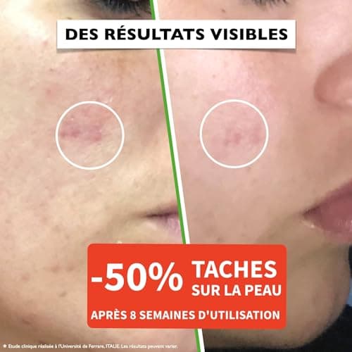 30ml. BIO Sérum Visage à la Vitamine C/E, Acide Hyaluronique Pur et Niacinamide. Anti-rides, Anti-taches et Hydratant. Soin Visage Anti-âge Idéal Comme Crème Contour des Yeux. Bouteille PET