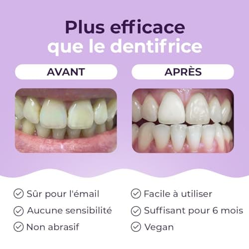 Poudre de blanchiment des dents Onlysmile pour dents blanches | Blanchiment dentaire professionnel | Effet nettoyant visible | Blanchisseur de dents sûr et indolore - Nettoyage cosmétique des dents