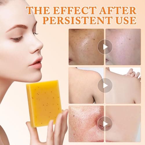 Savon à l'acide kojique au curcuma Savon au citron, Savon à l'acide kojique original, Savon au curcuma pour le visage et le corps, les taches brunes (2 pièces)