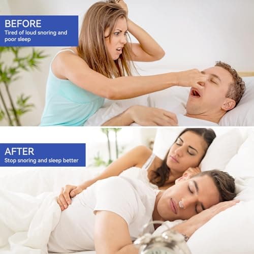 Annsky Anti Ronflement Efficace Puissant, Lot De 10 Pince-Nez Dispositifs Anti-Ronflement Pour Hommes Et Femmes, Pince Nez MagnéTique En Silicone Pour Une Meilleure Respiration Et Un Sommeil
