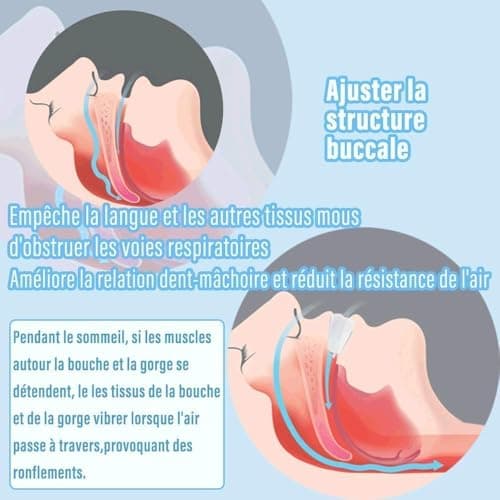 GouttièRe Dentairec Mise à Niveau MatéRielle2.0 Plus Doux Et Plus éLastique Ne Fait Pas Mal à La Bouche Anti Ronflement Efficace Puissant Apnee Du Sommeil Appareil Stockage IndéPendant 2PCS