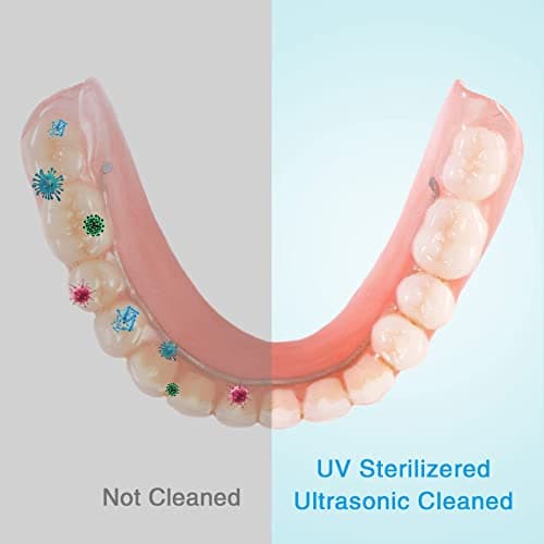 Nettoyeurs ultrasoniques pour prothèses dentaires, gouttières de blanchiment, protège-dents de nuit, tête de brosse à dents, boîte de nettoyage ultrasonique pour tous les appareils dentaires, bijoux