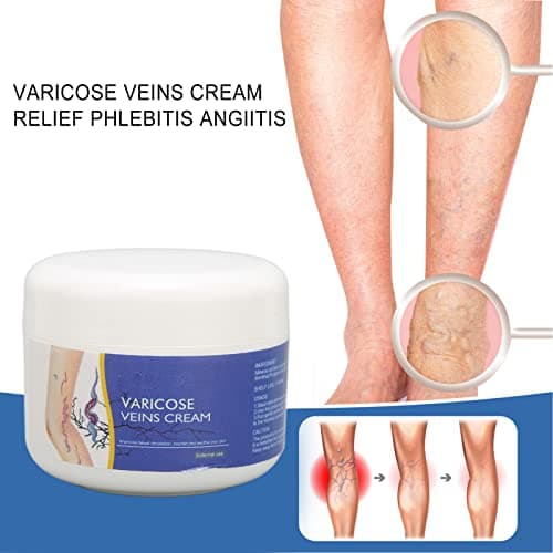 50g Crème De Traitement des Varices Crème Pour les Varices Ingrédients Naturels Hydrate la Crème Réparatrice des Varices Pour Améliorer L'apparence des Jambes