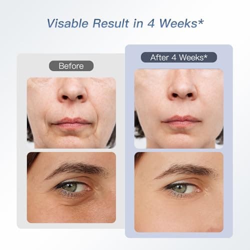 IBORRIA 2MHz Appareil Radiofréquence Visage, Aura2 Pro Appareil Anti Rides Visage Lifting, Luminothérapie Appareil Massage Visage, 90kHz EMS Appareils De Tonification Pour Le Lifting Visage (bleu)