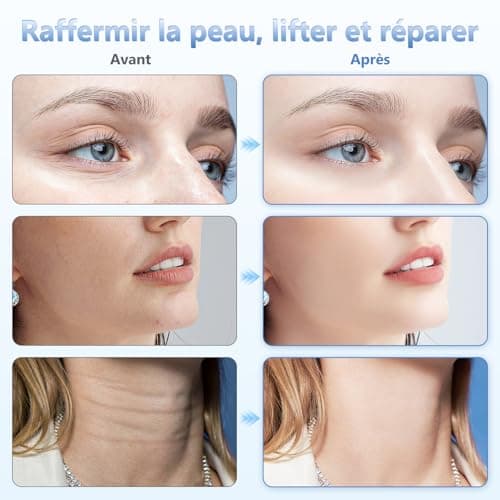 Appareil Anti Rides Visage, Appareil de Beauté à 6 Modes, Température 45 °C pour Les Massage Visage, pour l'anti-âge, Le Lifting et le Raffermissement de la Peau Relâchée (Mode LED 4 couleurs)