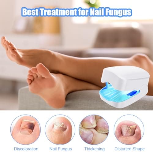 ACWOO Appareil Traitement Laser Mycose Ongles, Portable Dispositif des Champignons des Ongles, Dispositif de Traitement Laser pour Mycose Ongles des Pieds Nettoyage et Réparation Ongles Traitement