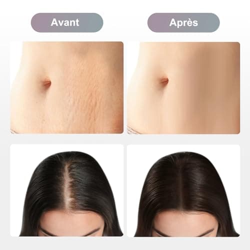 M8 Microneedling Pen - Réglable Dermapen Microneedling, Appareil Électrique Professionnel de Microneedling pour le Visage, le Corps et la Croissance des Cheveux/Barbe avec 8 Cartouches