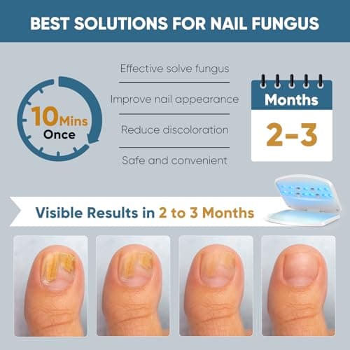 Dispositif de Laser pour Mycose Des Ongles, Berrlly Dispositif des Champignons des Ongles Utiliser pour Plusieurs Ongles, Hauteur Réglable de Haut en Bas, Ne Vous Inquiétez Vous avez Ongles Coincés