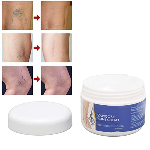 50g Crème De Traitement des Varices Crème Pour les Varices Ingrédients Naturels Hydrate la Crème Réparatrice des Varices Pour Améliorer L'apparence des Jambes