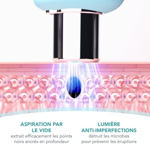 FOREO KIWI Aspirateur point noir et blanc visage - Skincare visage - Extracteur point noir visage et nez - Extraction sans bandelettes - Tire comédon point noir rapide et efficace