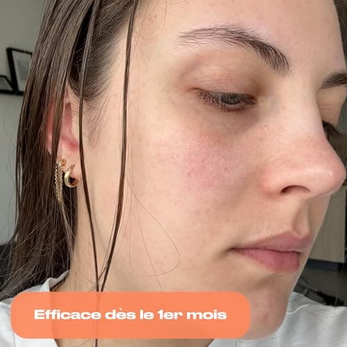 NEEO | Traitement Acné | Puissant Complexe de Zinc, Bardane, Ortie + Vitamines Peau Nette B2 et B3 | Testé en Laboratoire | Anti Acne Hormonal, Anti Imperfection, Anti Tache Visage | 30 Gélules Vegan