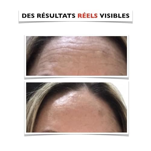 30ml. BIO Sérum Visage à la Vitamine C/E, Acide Hyaluronique Pur et Niacinamide. Anti-rides, Anti-taches et Hydratant. Soin Visage Anti-âge Idéal Comme Crème Contour des Yeux. Bouteille PET