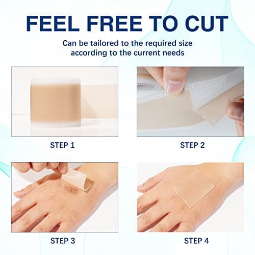 Feuilles de cicatrice en silicone (1,6"x130"-3,3M), bandes de ruban adhésif en silicone de qualité médicale pour incisions chirurgicales, césarienne, chéloïde, acné