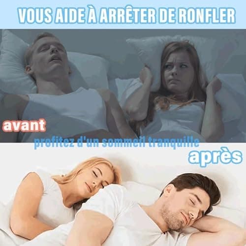 GouttièRe Dentairec Mise à Niveau MatéRielle2.0 Plus Doux Et Plus éLastique Ne Fait Pas Mal à La Bouche Anti Ronflement Efficace Puissant Apnee Du Sommeil Appareil Stockage IndéPendant 2PCS