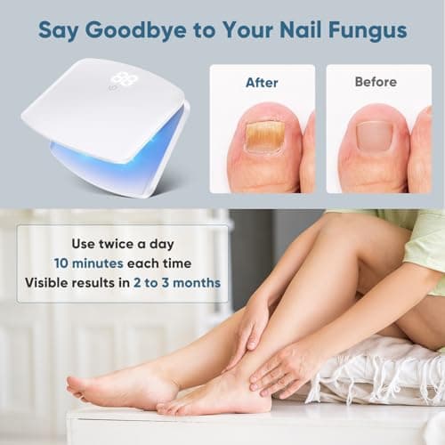 Dispositif de Laser pour Mycose Des Ongles, Berrlly Dispositif des Champignons des Ongles Utiliser pour Plusieurs Ongles, Hauteur Réglable de Haut en Bas, Ne Vous Inquiétez Vous avez Ongles Coincés
