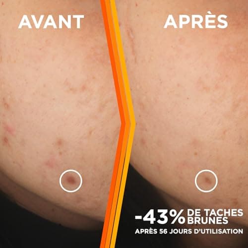 GARNIER Skin Active - Sérum Éclat - Anti-Tache Brunes - Soin Visage Enrichi En Vitamine C, Acide Salicylique &Niacinamide - Tous Types de Peaux - Vegan & Cruelty Free - 30 ml