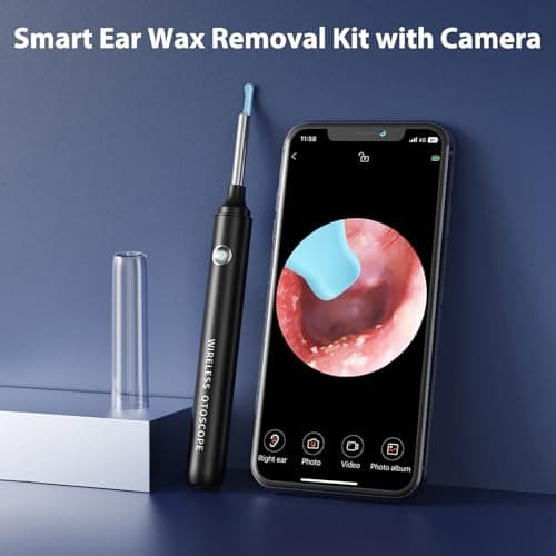 Otoscope Oreille, Hopefox 1080P Camera Oreille IP67 Étanche, Outil d'élimination du Cérumen, Endoscope WIFI Nettoyant Oreille Kit avec 6 Lumières LED, Adapté aux iPhone, iPad et Android