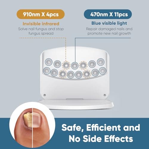 Dispositif de Laser pour Mycose Des Ongles, Berrlly Dispositif des Champignons des Ongles Utiliser pour Plusieurs Ongles, Hauteur Réglable de Haut en Bas, Ne Vous Inquiétez Vous avez Ongles Coincés