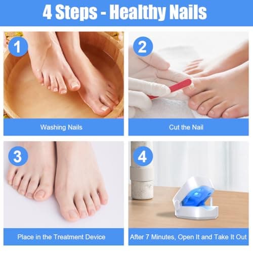 ACWOO Appareil Traitement Laser Mycose Ongles, Portable Dispositif des Champignons des Ongles, Dispositif de Traitement Laser pour Mycose Ongles des Pieds Nettoyage et Réparation Ongles Traitement