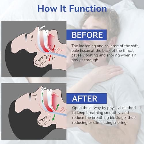 Annsky Anti Ronflement Efficace Puissant, Lot De 10 Pince-Nez Dispositifs Anti-Ronflement Pour Hommes Et Femmes, Pince Nez MagnéTique En Silicone Pour Une Meilleure Respiration Et Un Sommeil
