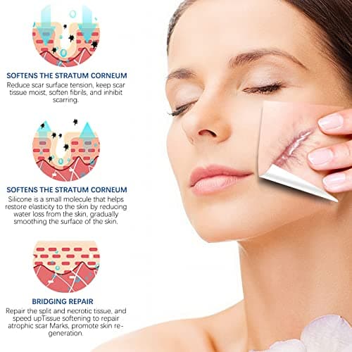 Feuilles de cicatrice en silicone (1,6"x130"-3,3M), bandes de ruban adhésif en silicone de qualité médicale pour incisions chirurgicales, césarienne, chéloïde, acné