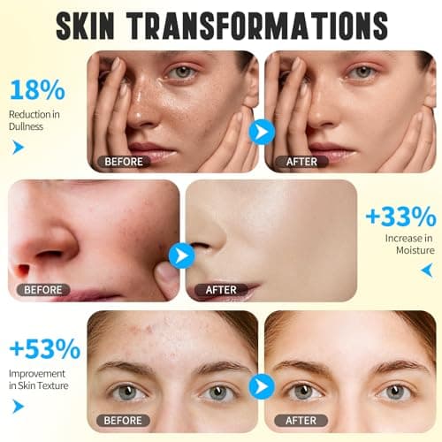 Nettoyant Facial Au Curcuma Et À L'Acide Kojique, Mousse Exfoliante Nettoyante, Combat L'Acné, Équilibre L'Huile Et L'Eau De La Peau, Éclaircit Le Teint De La Peau 150Ml