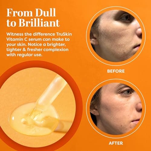 TruSkin Vitamin C Serum - Sérum anti-âge pour le visage à la vitamine C avec acide hyaluronique, vitamine E, aloès - Sérum éclaircissant pour les taches brunes, les ridules et les rides, 1 Fl Oz