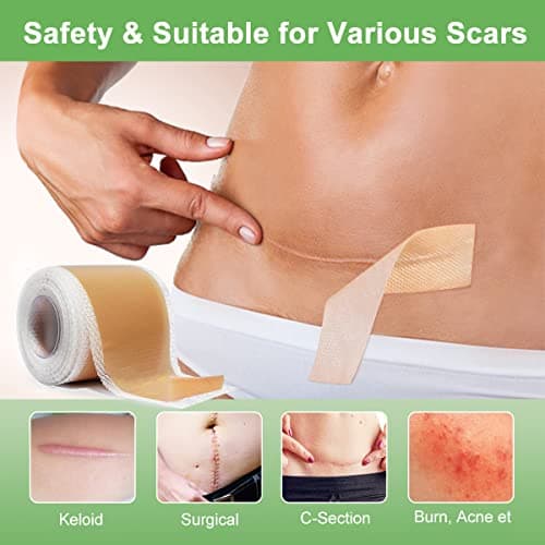 Feuilles de cicatrice en silicone (1,8 "x 120" -3M), bandes de ruban adhésif en silicone de qualité médicale pour incisions chirurgicales, césarienne, chéloïde, acné
