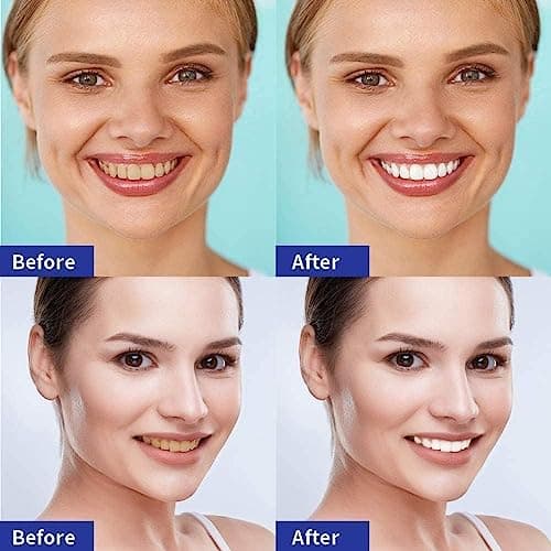Blanchiment Dentaire, 28 Bande Blanchiment Dentaire 14 Ensembles Blanchisseur de Dents pour le Blanchiment des Dents Kit de Blanchiment des Dents-Blanchiment Dentaire Blanchiment Des Dents