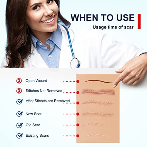 Feuilles de cicatrice en silicone (1,8 "x 120" -3M), bandes de ruban adhésif en silicone de qualité médicale pour incisions chirurgicales, césarienne, chéloïde, acné