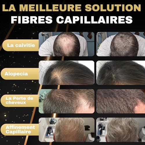 Poudre Densifiante Cheveux Salvathor Duran 2x25g (50g Total) - Poudre Cheveux - Fibre Capillaire 50 g - Poudre Densifiante pour Cheveux- Poudre Anti Calvitie