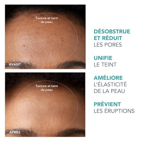 FOREO KIWI Aspirateur point noir et blanc visage - Skincare visage - Extracteur point noir visage et nez - Extraction sans bandelettes - Tire comédon point noir rapide et efficace