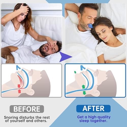 Anti Ronflement Anti Ronflement Efficace Puissant Ecarteur Nasal Anti Ronflement et Langue en Silicone Dilatateur Nasal ApnÉE Du Sommeil Orthese Anti Ronflement Dispositifs Anti Ronflement Sport