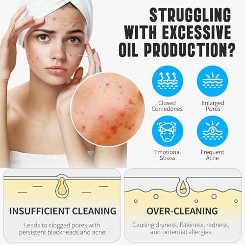Nettoyant Facial Au Curcuma Et À L'Acide Kojique, Mousse Exfoliante Nettoyante, Combat L'Acné, Équilibre L'Huile Et L'Eau De La Peau, Éclaircit Le Teint De La Peau 150Ml
